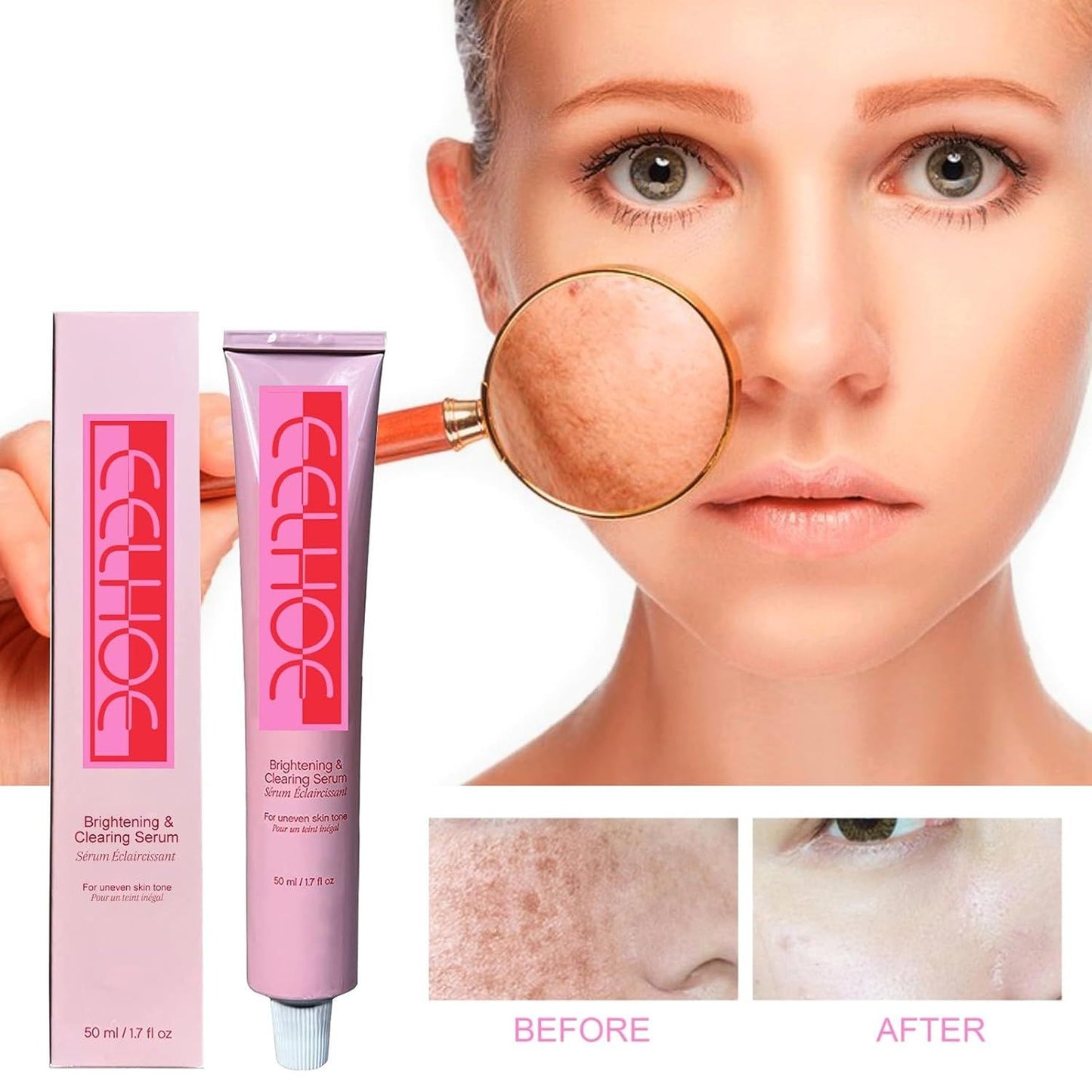 Eelhoe Brightening and Clearing Serum tube and box showing skin before and after dark spot removal  أنبوب وعلبة سيروم إيلهو لتفتيح البشرة وإزالة البقع الداكنة مع نتائج قبل وبعد
