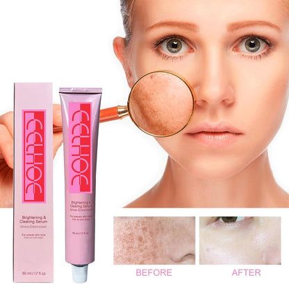 Eelhoe Brightening and Clearing Serum tube and box showing skin before and after dark spot removal  أنبوب وعلبة سيروم إيلهو لتفتيح البشرة وإزالة البقع الداكنة مع نتائج قبل وبعد